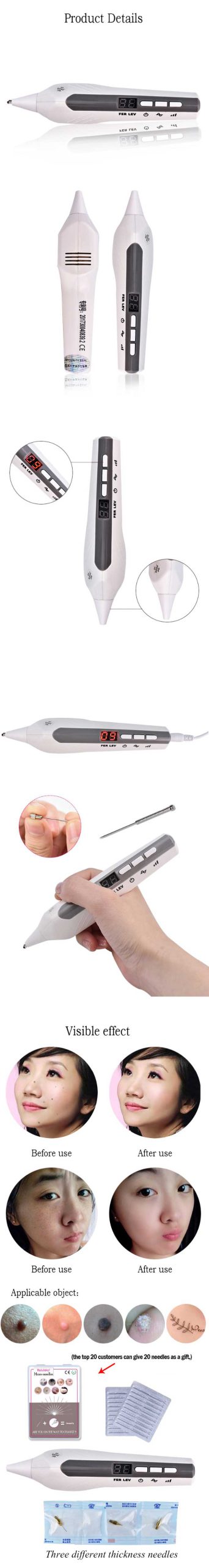 دستگاه پلاسما بکو حذف خال و تتو و زگیل