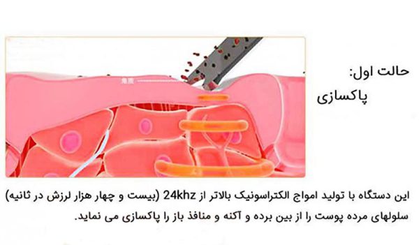 دستگاه اتو پوست التراسونیک