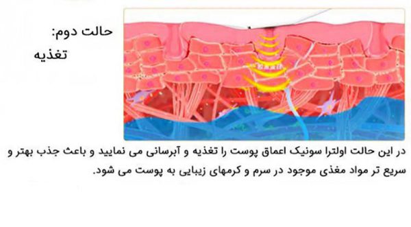 دستگاه اتو پوست التراسونیک