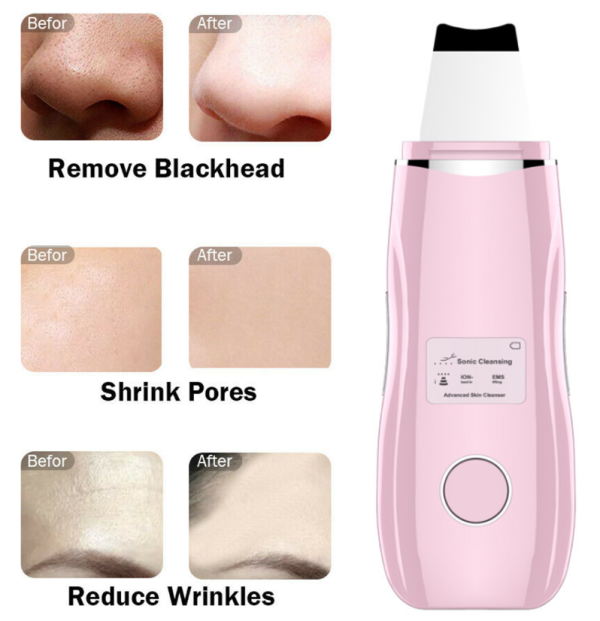 دستگاه اتو صورت التراسونیک Skin Scrubber