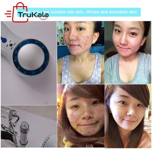 دستگاه آکواپیل 5 کاره