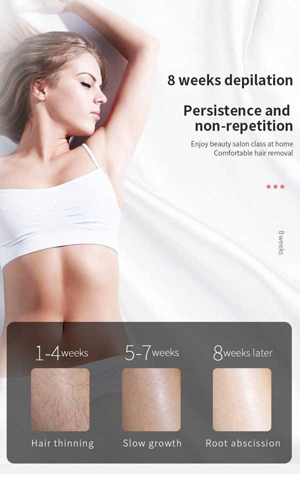 دستگاه لیزر خانگی حذف مو زائد صورت و بدن