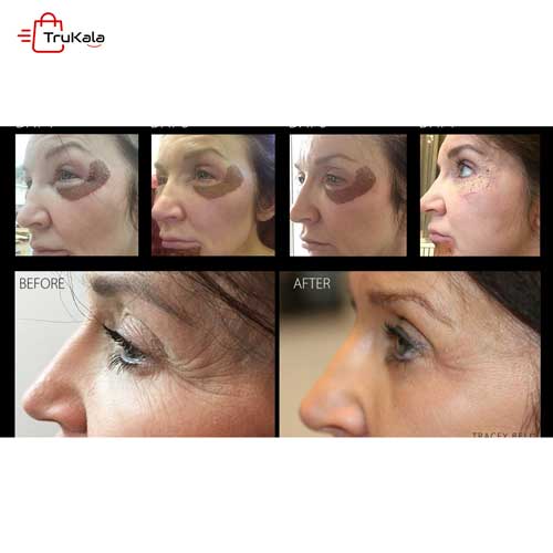 دستگاه اوزون پلاس 2 هندپیس گلد