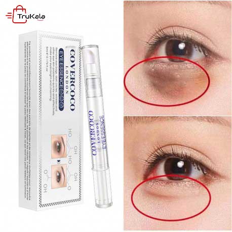 سرم امپولی دور چشم هیالورونیک اسید