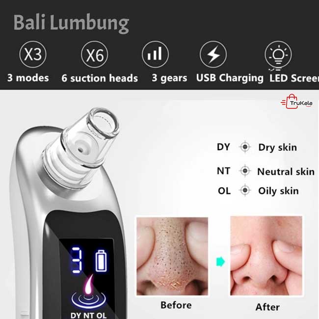 میکرودرم دیجیتالی پاریس استایل 7