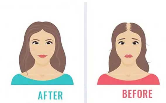 کوکتل ضد ریزش مو مزولایک 6