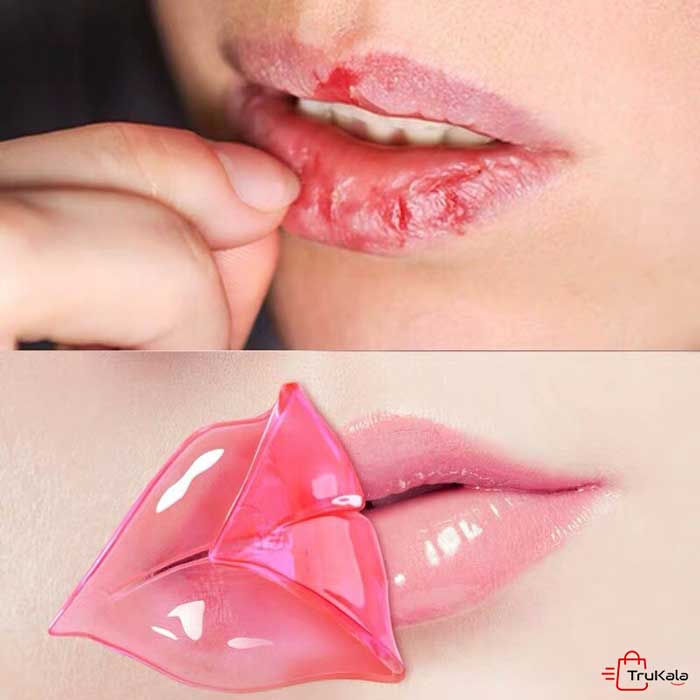 ماسک لب ونزن 8