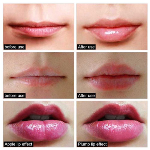 حجم دهنده لب مدل lip plumper