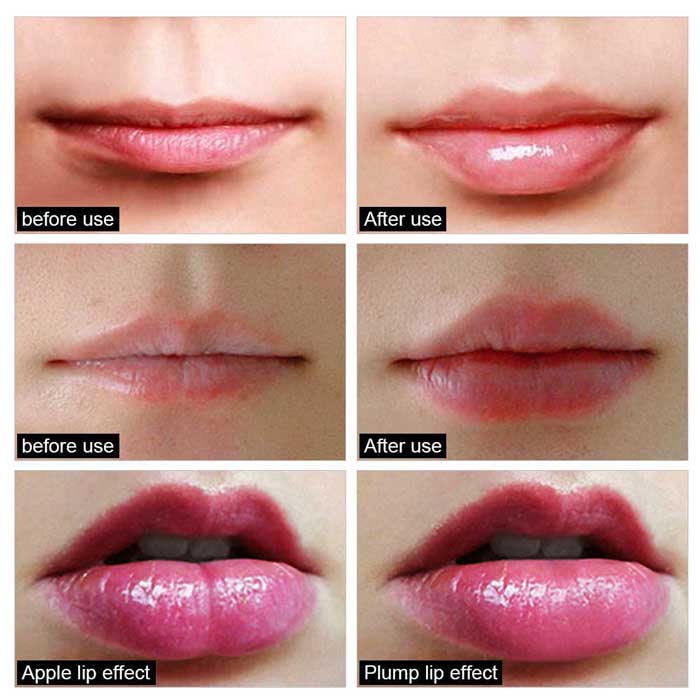 حجم دهنده لب مدل lip plumper