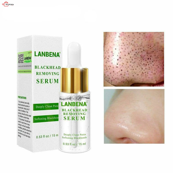 سرم رفع جوش سر سیاه لانبنا