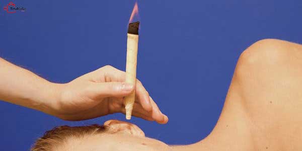 شمع پاکسازی گوش