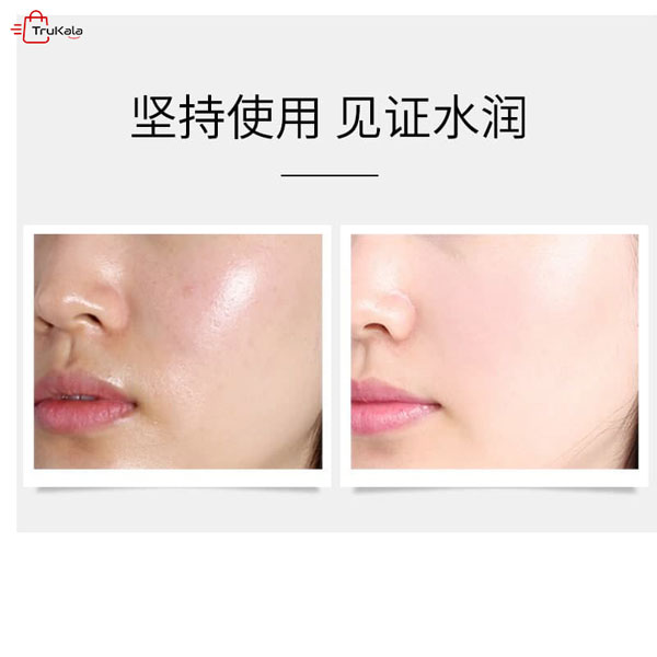 سرم هیالورونیک اسید جومتام