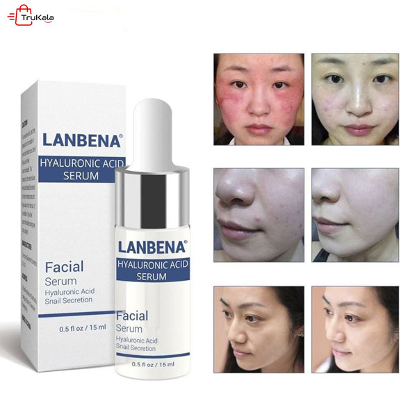 سرم هیالورونیک اسید لانبنا
