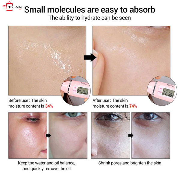 سرم هیالورونیک اسید ونزن