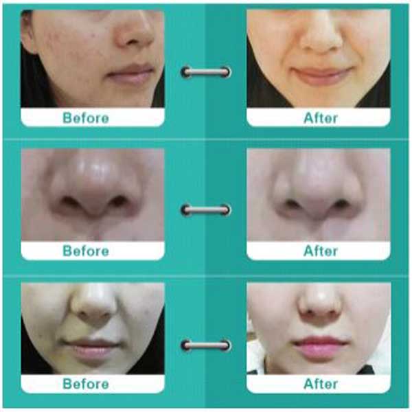 عملکرد اکوافیشیال 11 کاره