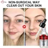 سرم ضد چروک صورت وی اچ ای