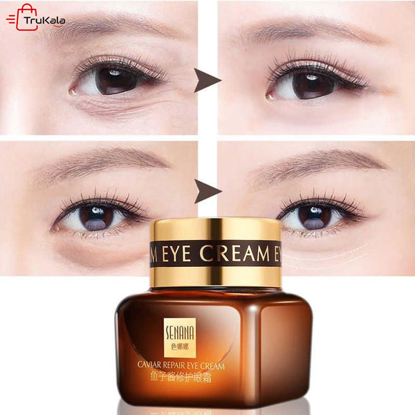 کرم دور چشم خاویار سنانا