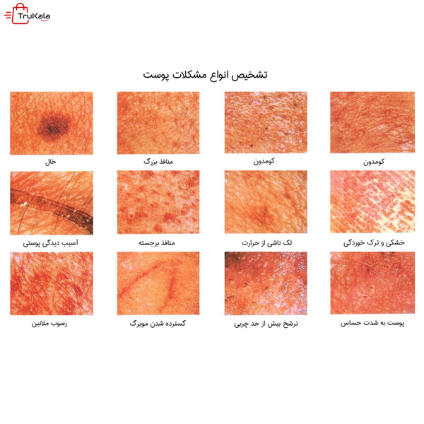 دستگاه آنالیزور پوست کلین