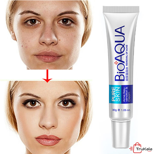 خرید کرم ضد جوش بیواکوا