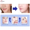 کرم زغال اخته بیوآکوا