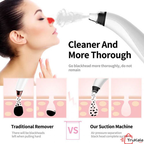 میکرودرم خانگی 53 کیلو پاسکال