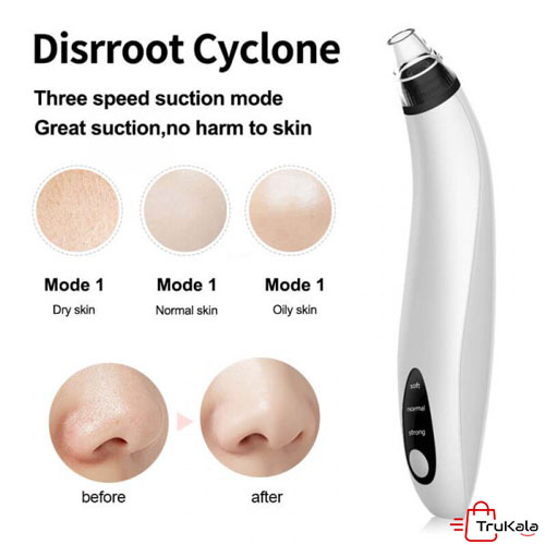 تاثیر میکرودرم خانگی 53 کیلو پاسکال