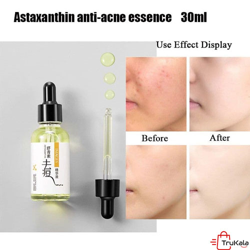 سرم ضد جوش و آکنه ایمجز