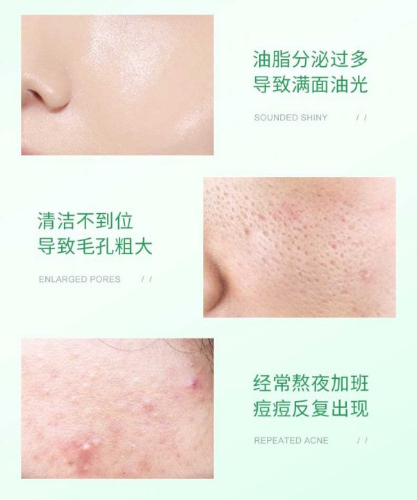 ژل سالیسیلیک اسید بیوآکوا