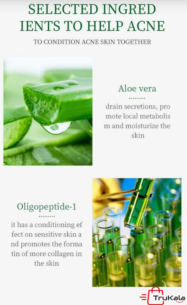 خرید سرم صورت اسید سالیسیلیک EXGYAN