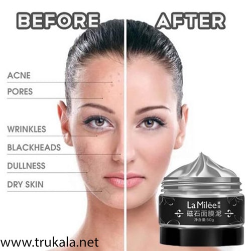 ماسک مغناطیسی جوش سرسیاه