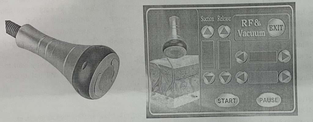 کویتیشن لاغری اراف 8 کیم 6 هندپیس انزوایتالیا