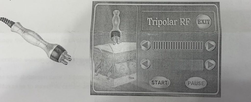 کویتیشن لاغری اراف 8 کیم 6 هندپیس انزوایتالیا