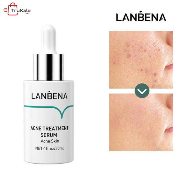 عملکرد سرم ضد جوش لانبنا