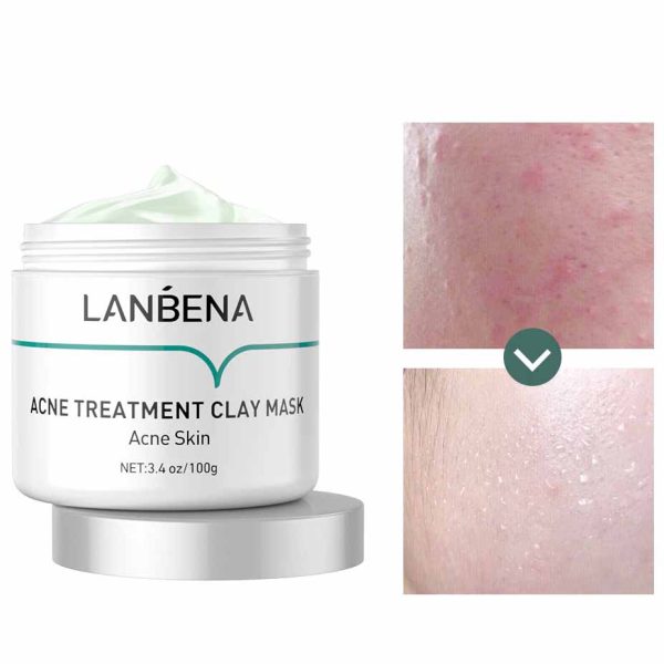 ماسک ضد جوش خاک رس لانبنا