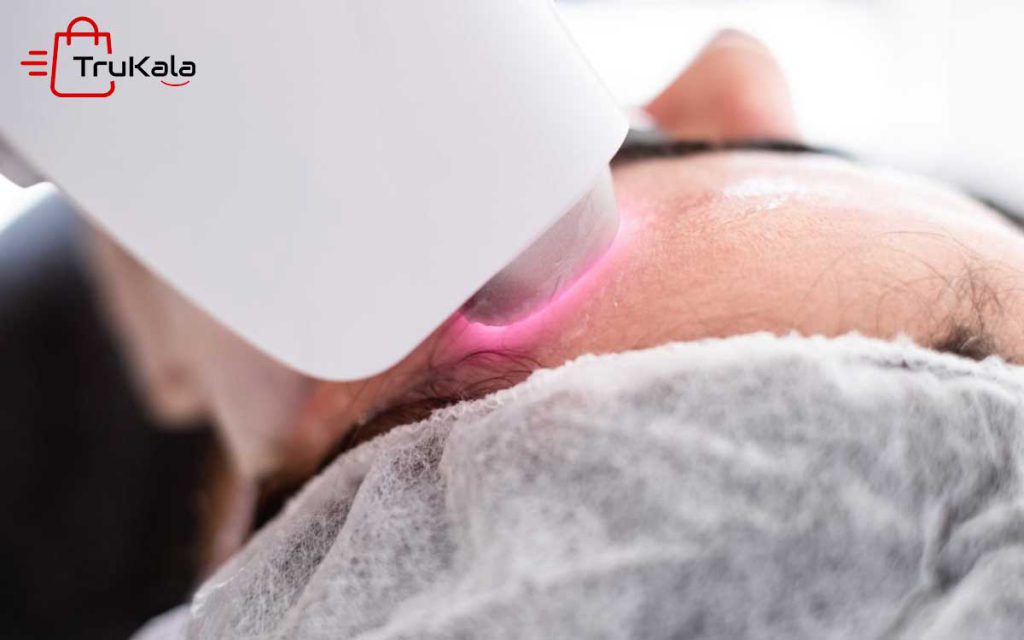 لیزر درمانی؛ بررسی کلی - تروکالا