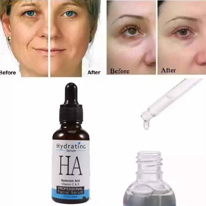 سرم هیدراتینگ هیالورونیک اسید مویام