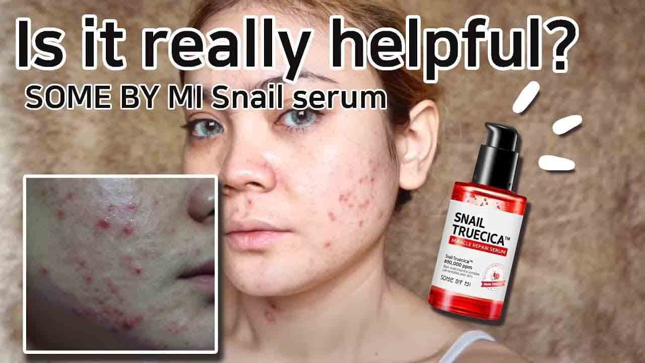 سرم معجزه هیالورنیک اسید حلزون سیاه روشان