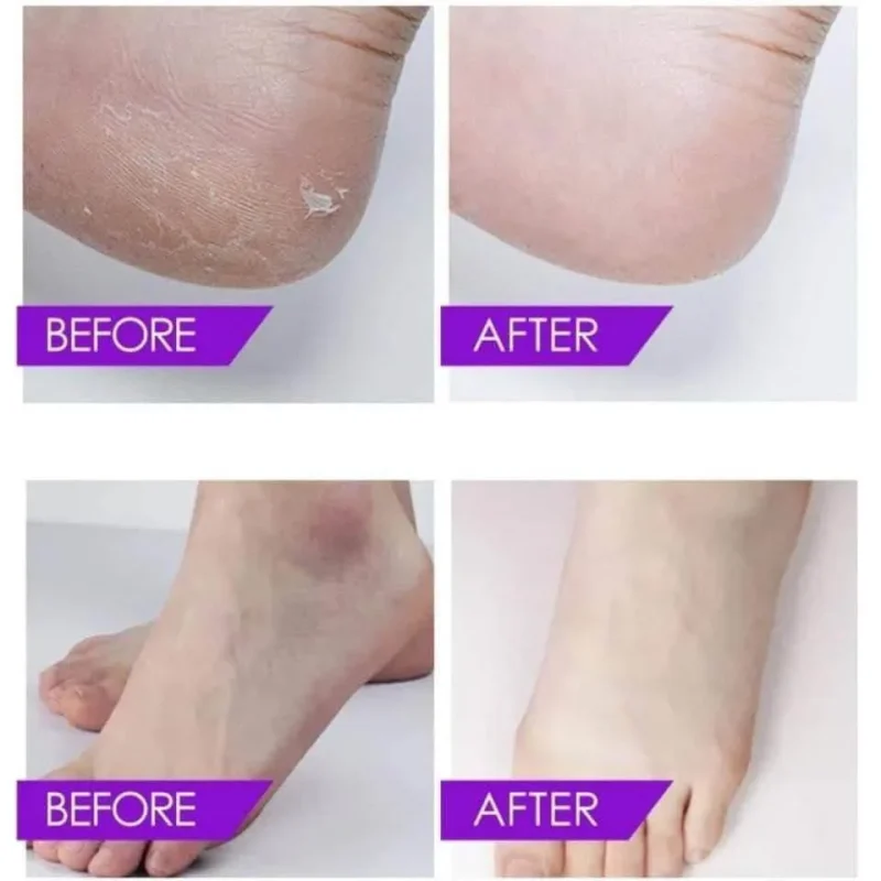 ماسک پودری هیدروژلی پا