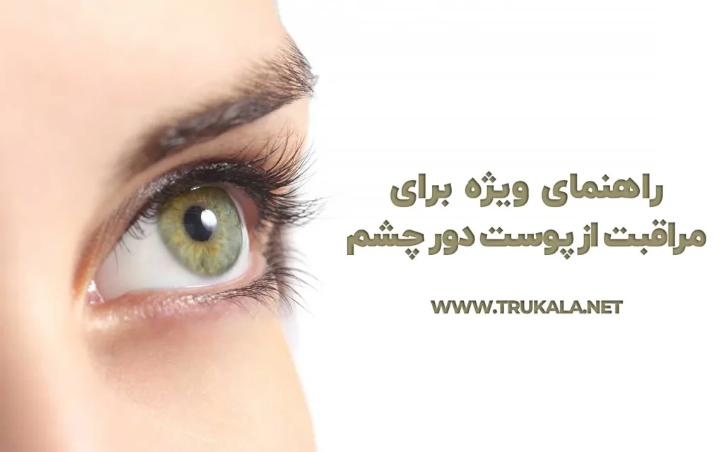 مراقبت دور چشم