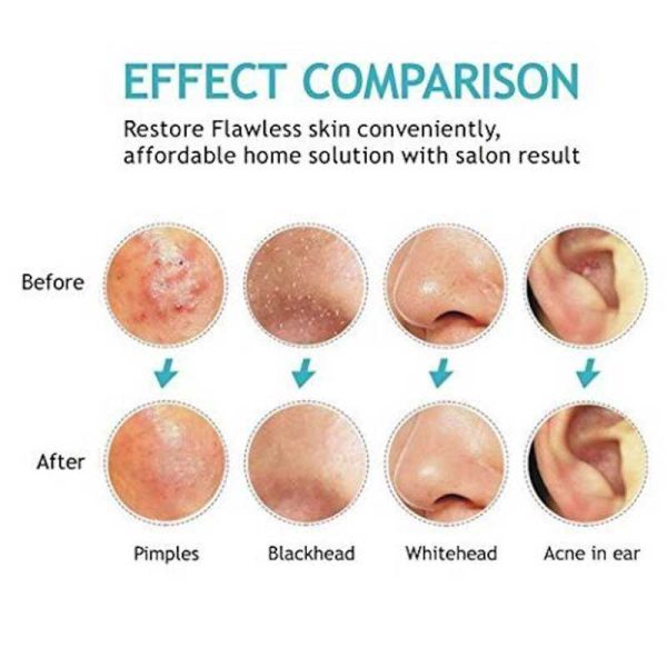 ست تیرکومدون شش تکه کیف چرمی