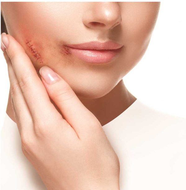 کرم پوست اسیب دیده ژیناژن