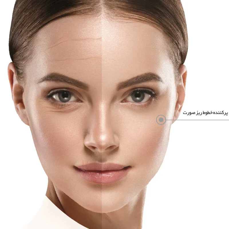 کرم روتوش ژیناژن بژ طبیعی