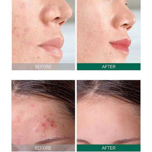 کیت سی روزه سام بای می 