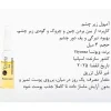 ویال دور چشم ویونسا