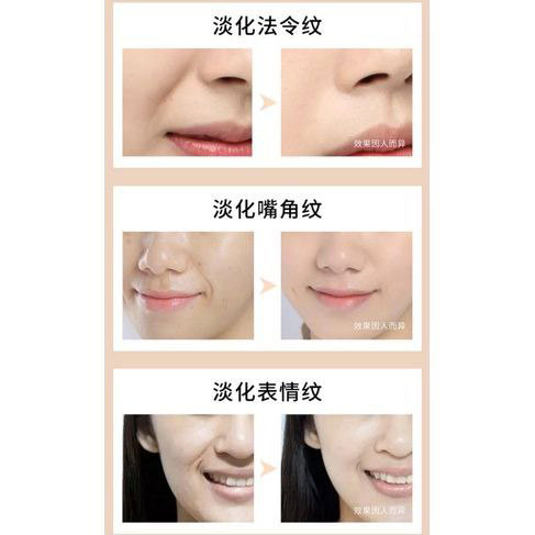 پچ خط خنده بیوآکوا