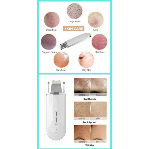 اتو صورت درمااف اولتراسونیک چهار کاره ایکوبیوتی