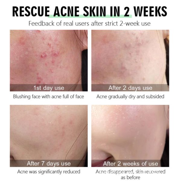 سرم ضدجوش چای سبز ویبرانت گلامور