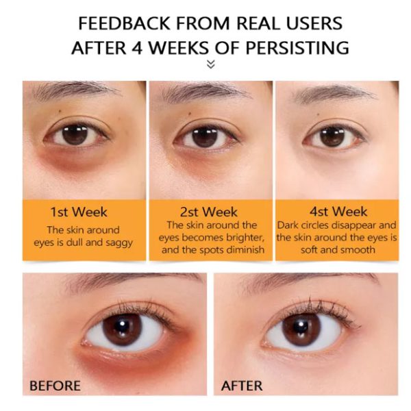 سرم دور چشم ویتامین سی ویبرانت گلامور