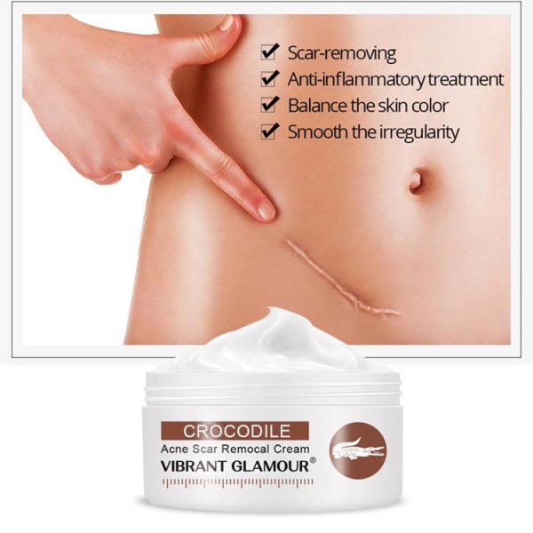 کرم از بین برنده جای زخم ویبرانت گلامور