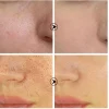 سرم کوچک کننده منافذ پوست بریلی
